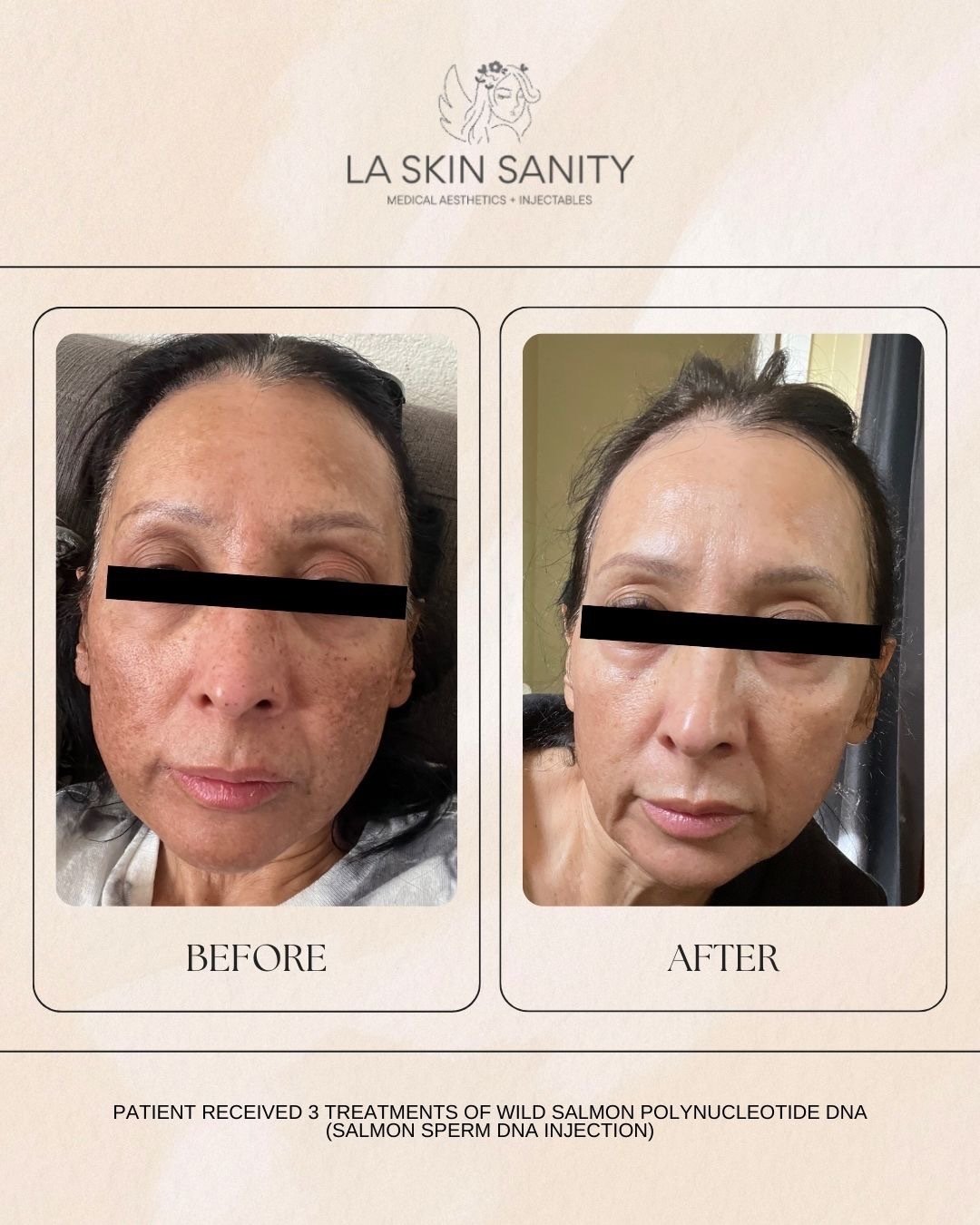 patient transformation