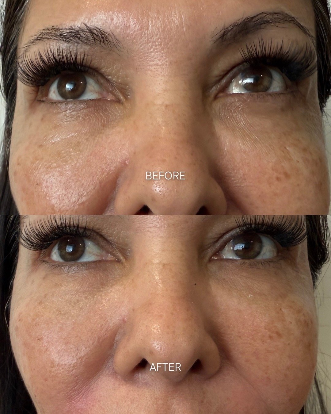 patient transformation