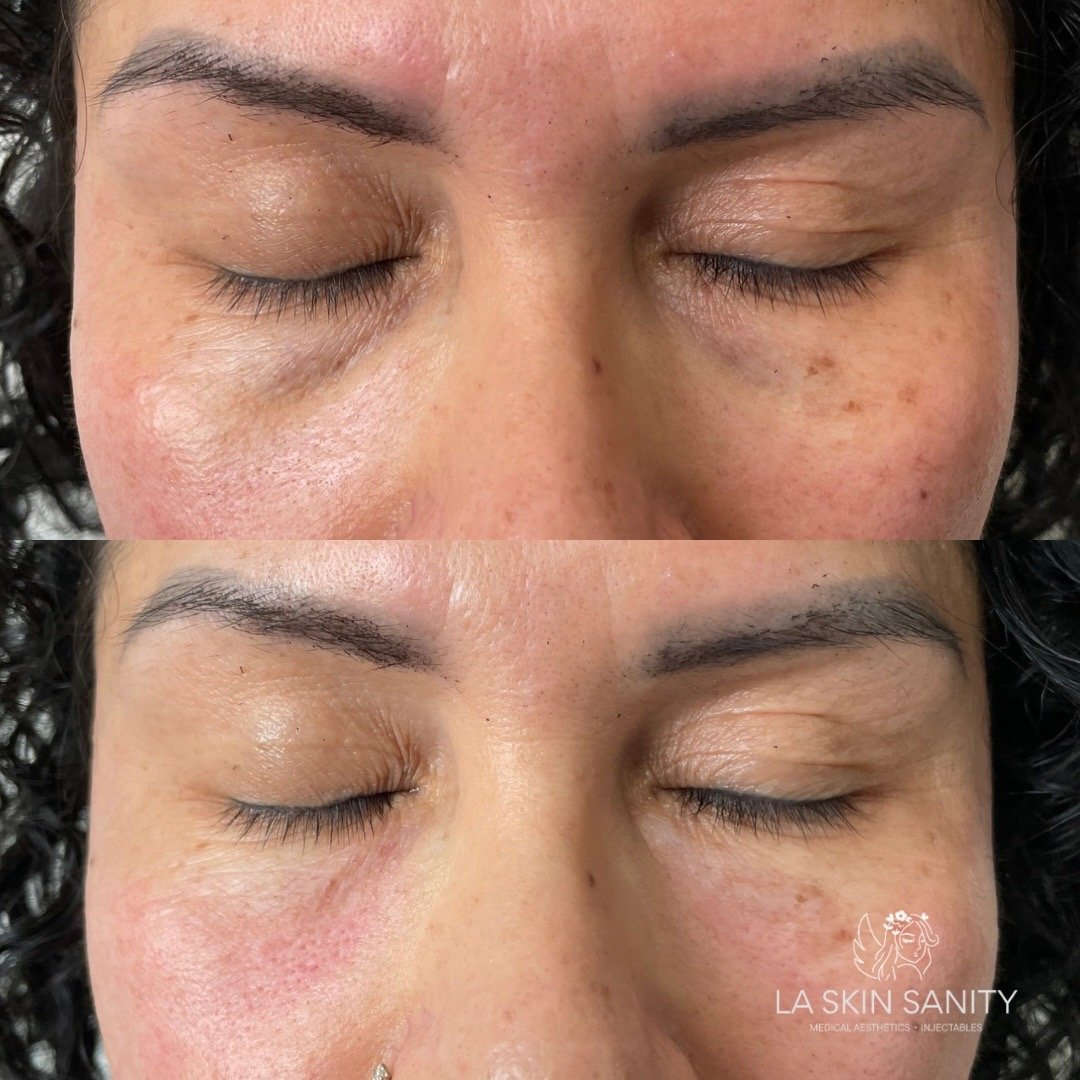 patient transformation2